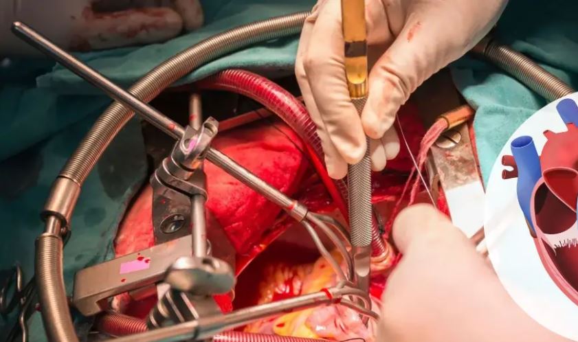 Heart Valve Repair & Replacement
