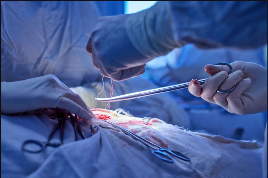 Vascular & Endovascular Surgery